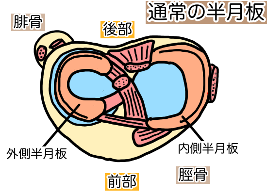 半月板ってなんですか 半月板損傷専門の あきら膝痛整体院 福岡市早良区 西新駅1分 半月板ってなんですか 半月板損傷専門の あきら膝痛整体院 福岡市早良区 西新駅1分