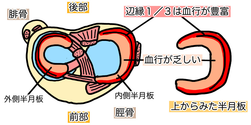 半月板損傷は自然治癒で完治が可能なのか 半月板損傷専門の あきら膝痛整体院 福岡市早良区 西新駅1分