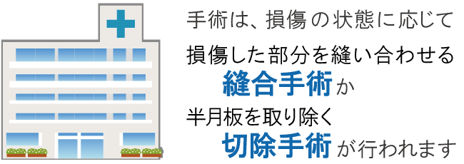 半月板損傷の手術について